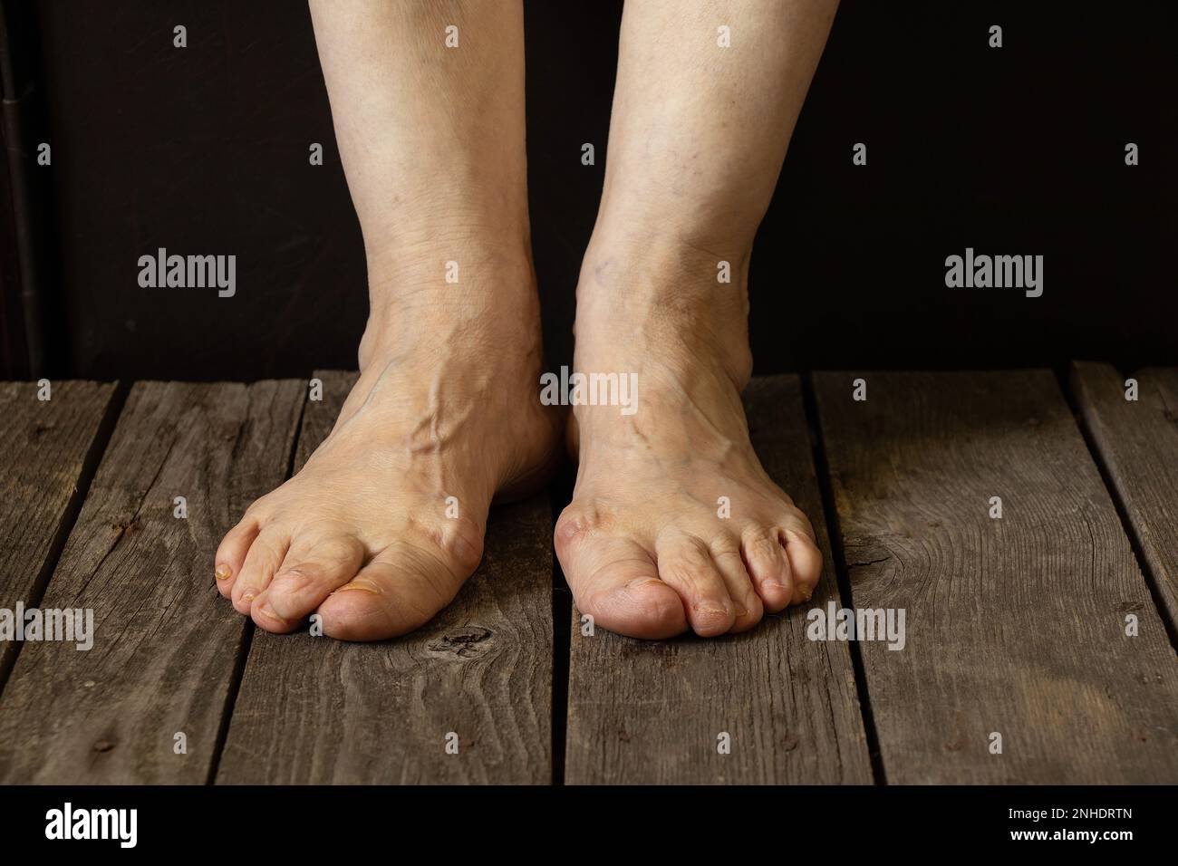 old grandmother's feet on the floor in her room close-up Stock Photo