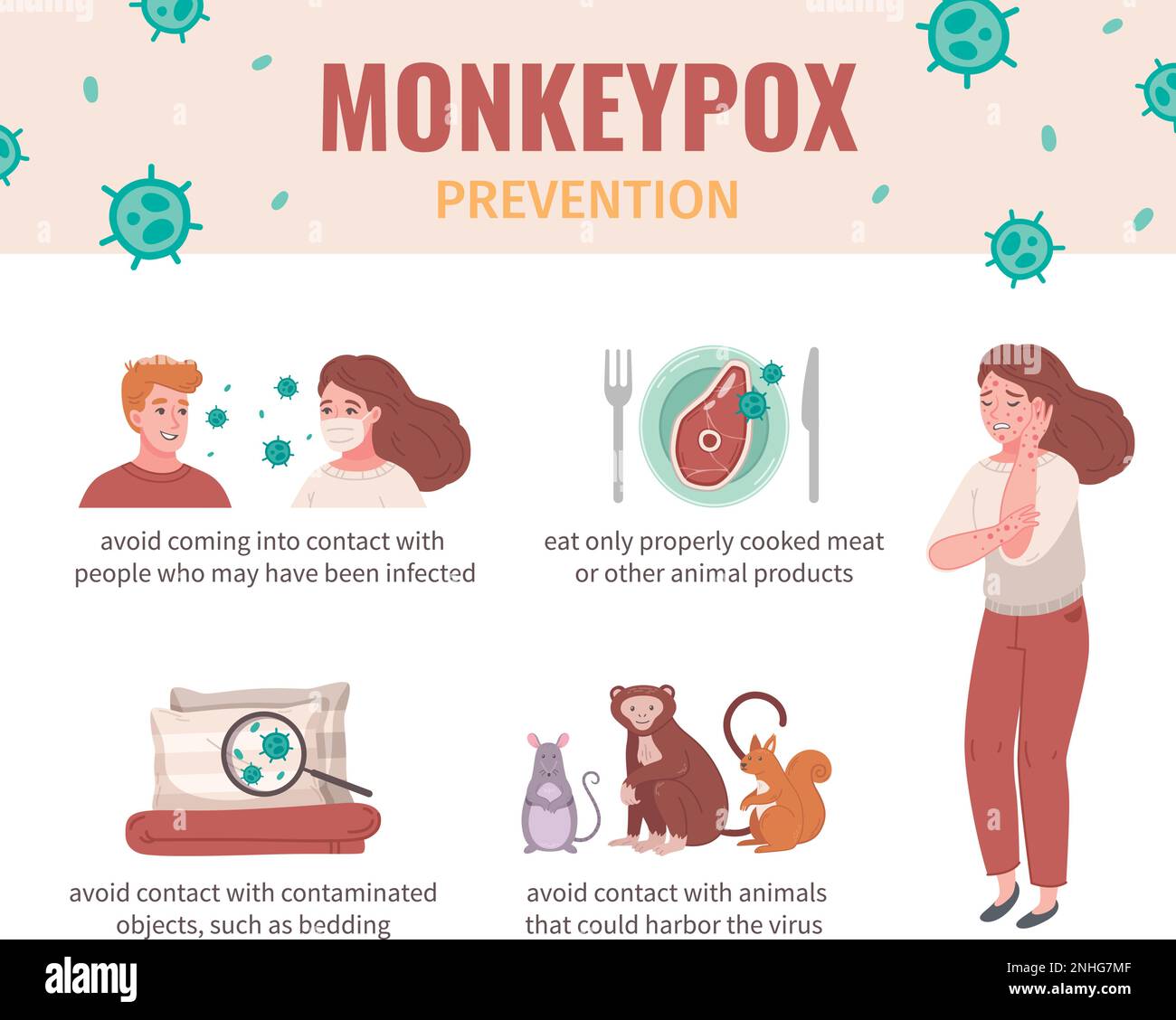 Monkey pox virus infographic set with desease prevention vector ...