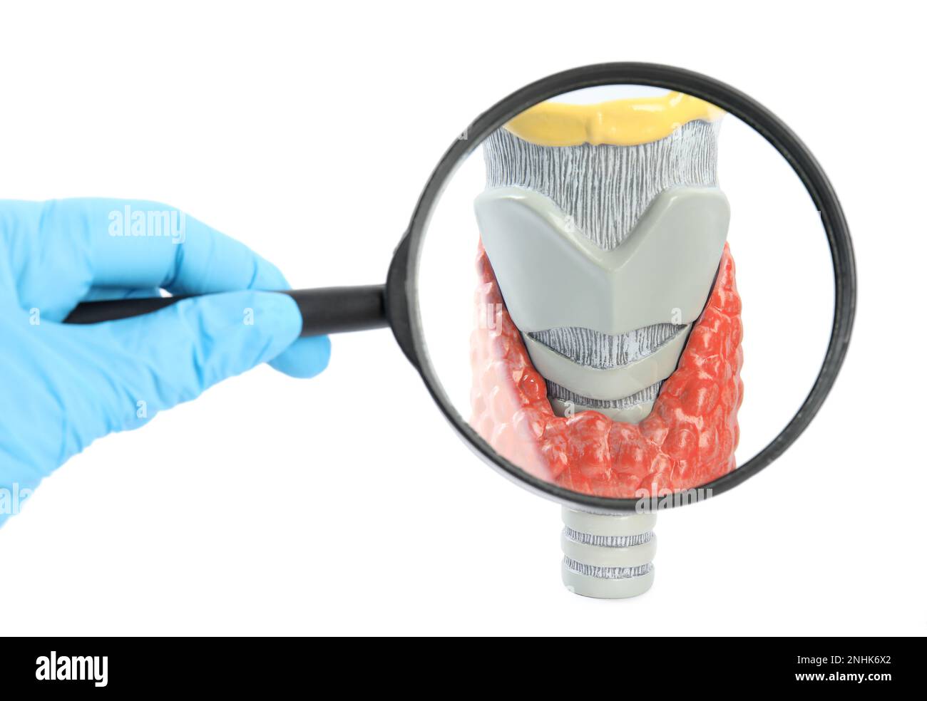 Doctor with magnifying glass looking at plastic model of afflicted thyroid on white background, closeup Stock Photo