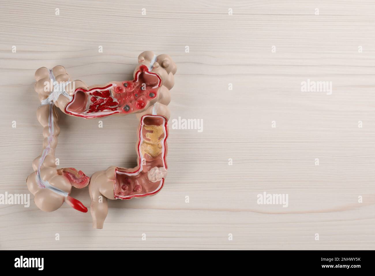 Human colon model on white wooden table, top view. Space for text Stock ...