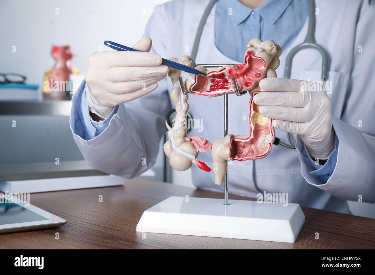 Gastroenterologist showing human colon model at table in clinic ...