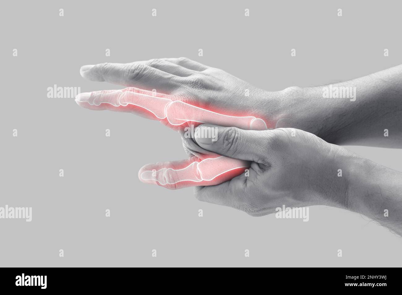 Illustration of the thumb and forefinger bones on a man's hand on a ...