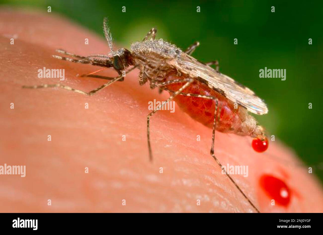 FILE - This file photo provided by the Centers for Disease Control and Prevention (CDC) shows a feeding female Anopheles stephensi mosquito crouching forward and downward on her forelegs on a human skin surface, in the process of obtaining its blood meal through its sharp, needle-like labrum, which it had inserted into its human host. Scientists said Tuesday, Nov. 1, 2022 that the invasive mosquito species Anopheles stephensi was likely responsible for a large outbreak of malaria in Ethiopia earlier this year, a finding that one expert called a worrying sign that progress against the disease i Stock Photo
