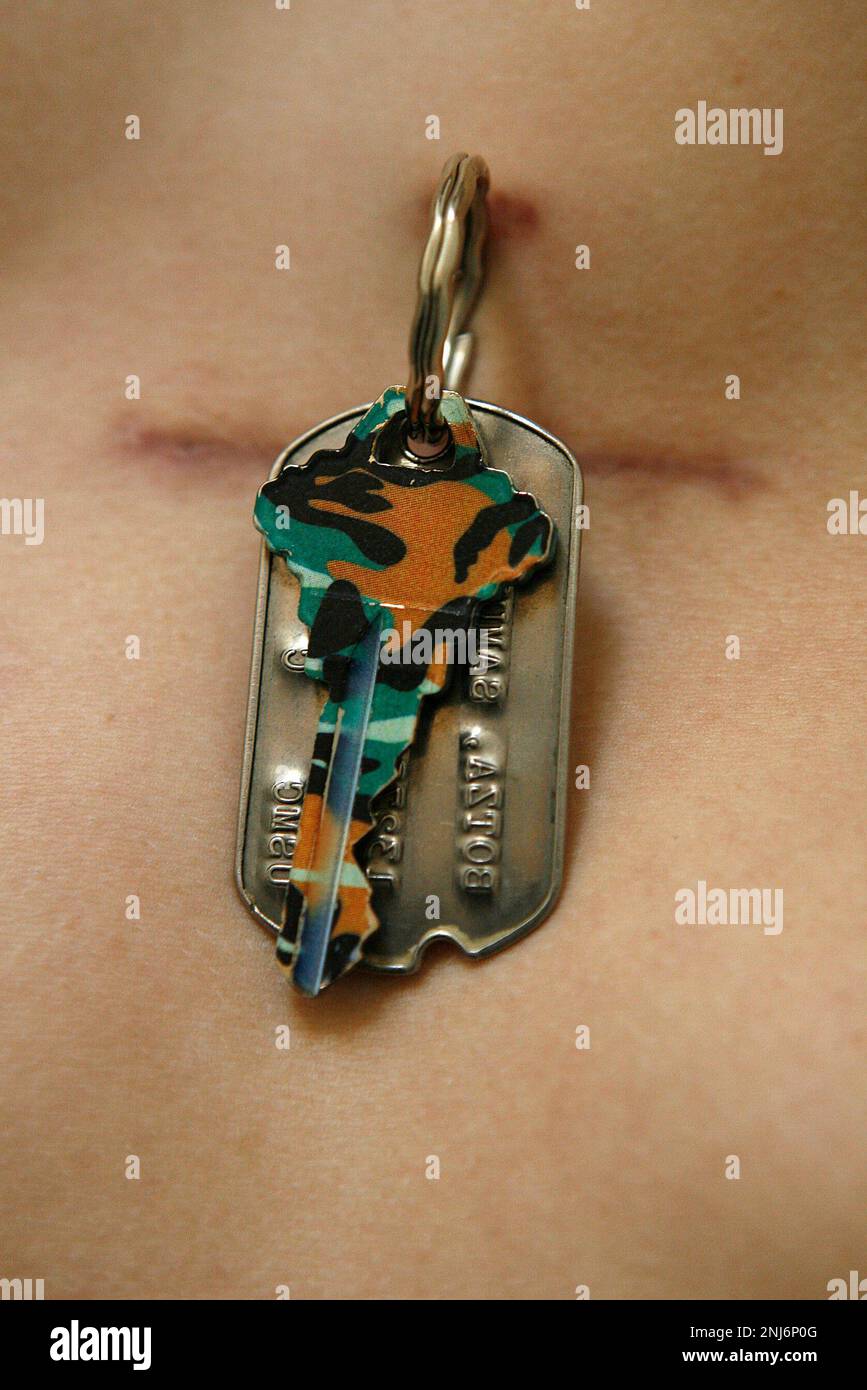 CHEST03 011 LH.JPG There's a new, minimallyinvasive technique