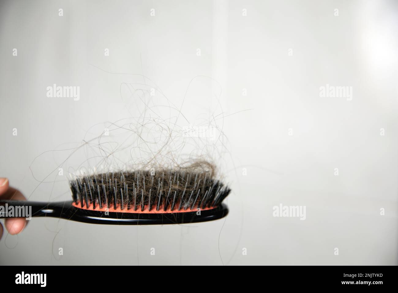 Hair loss problem, postpartum period, menstrual or endocrine disorder