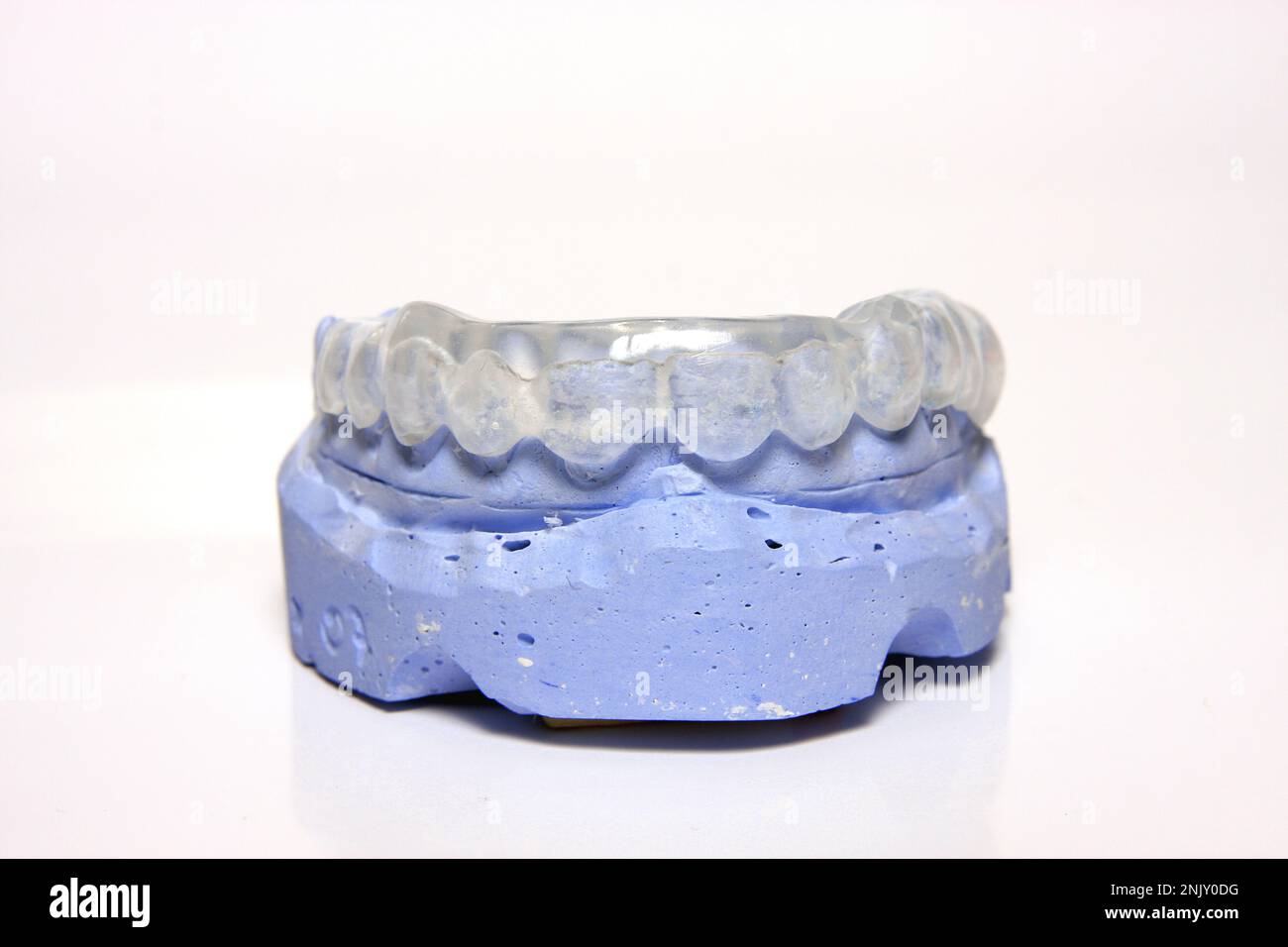 denture impression with grinding splint Stock Photo