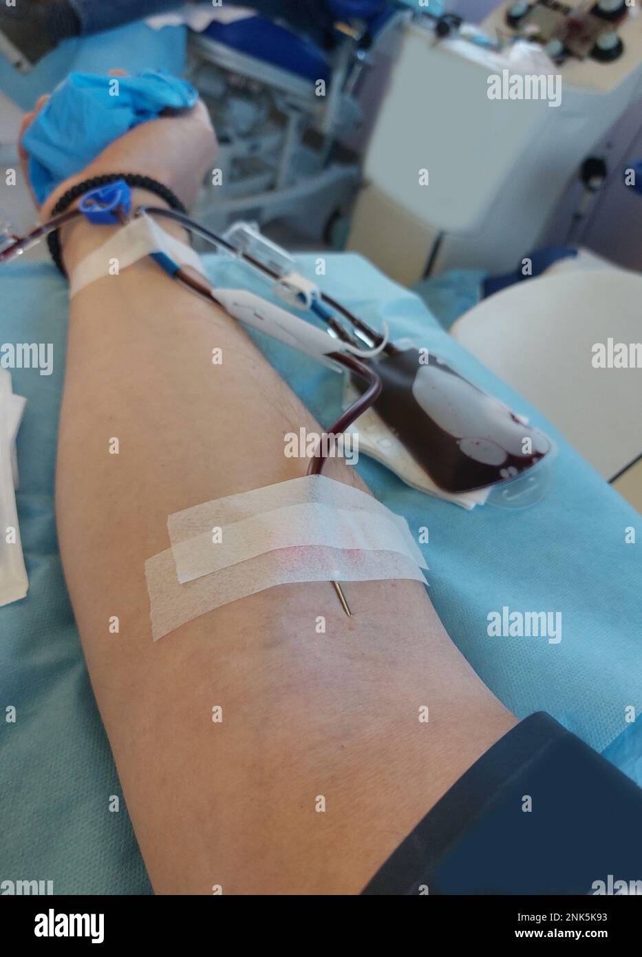 blood donor arm with big needle in arm during donation at hospital