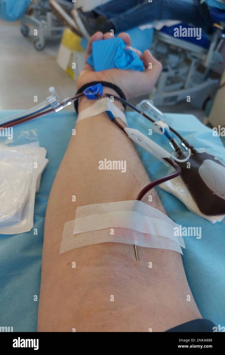 blood donor with big needle stuck in forearm during donation at