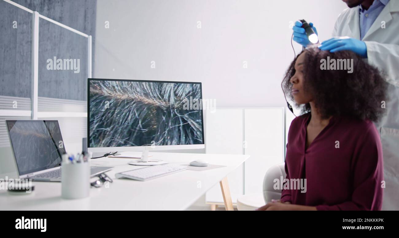 Hair Scalp Analysis For Dandruff. Woman Hair Fall Treatment Stock Photo