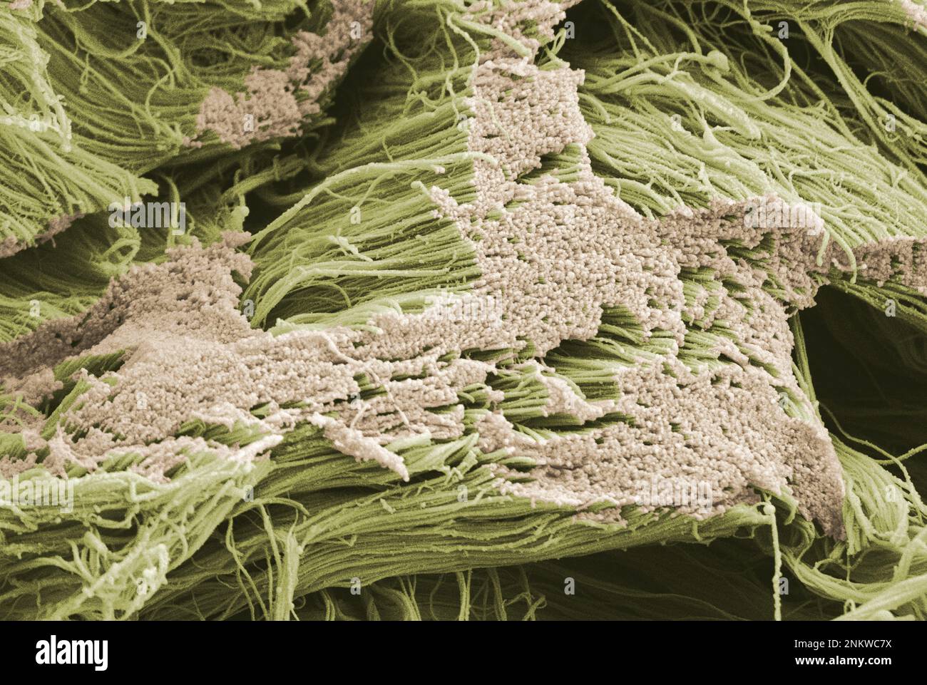 Sem Tissue Human connective tissue, SEM Stock Photo - Alamy