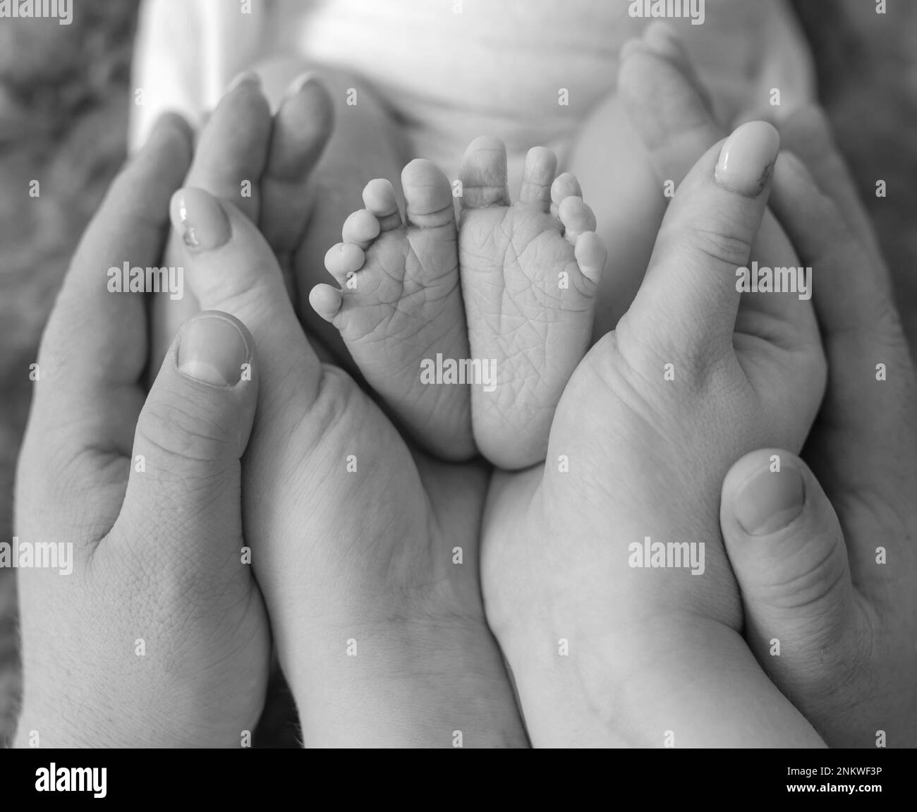 Newborn Baby Hands And Feet Purple at Jaime Trujillo blog