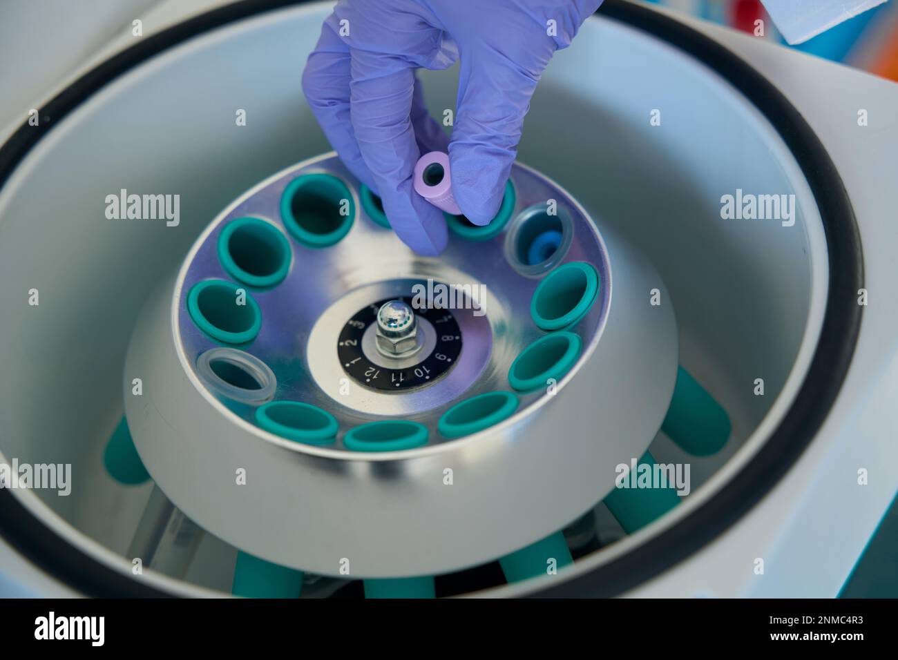 Hematologist removes a test tube with biomaterial from hematological ...