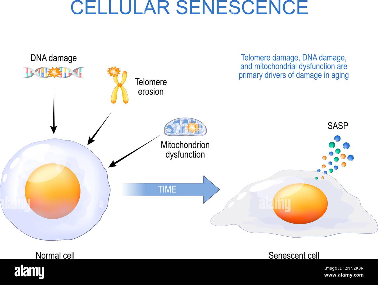 cellular senescence. From Normal to Senescent cell. Telomere and DNA damaged, mitochondrial dysfunction are primary drivers of damage in aging Stock Vector
