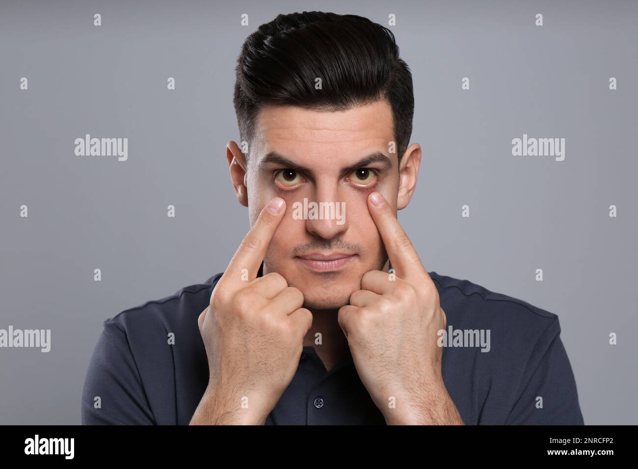 Man checking his health condition on grey background. Yellow eyes as