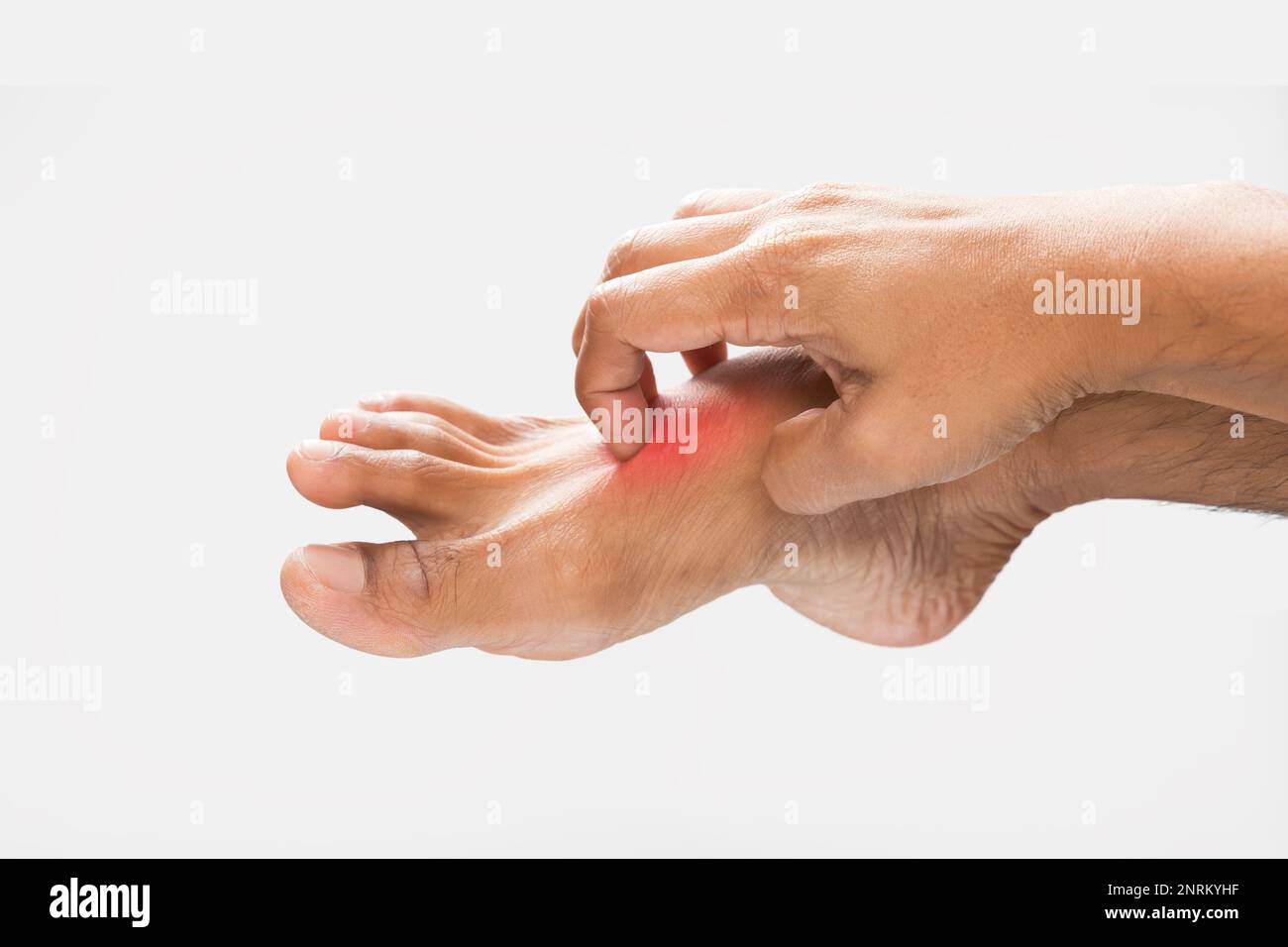 Have a itching foot. Healthcare and medical concept Stock Photo Alamy