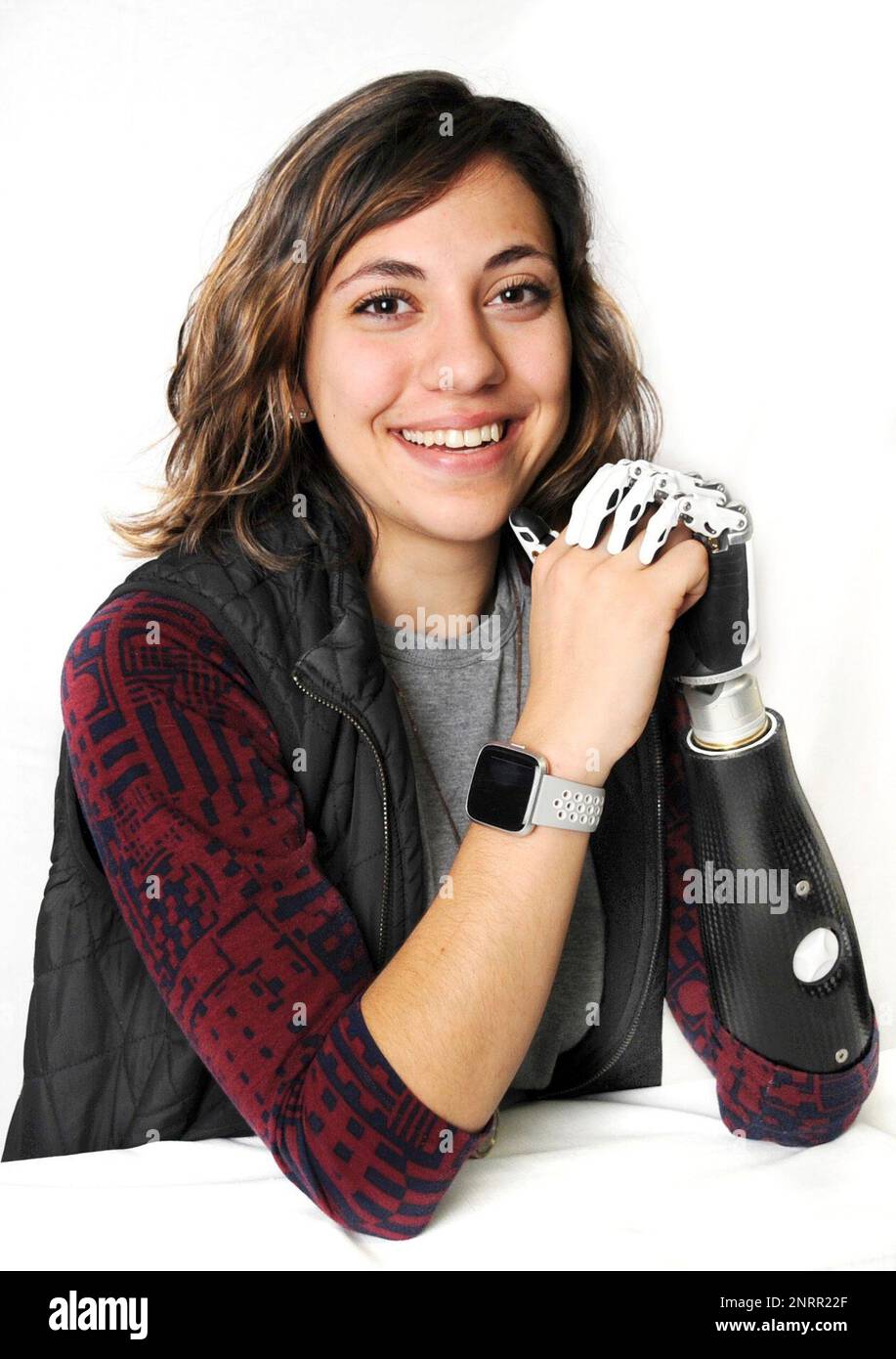 Rita Homan shows off her new bionic arm in Celina, Ohio, on Thursday