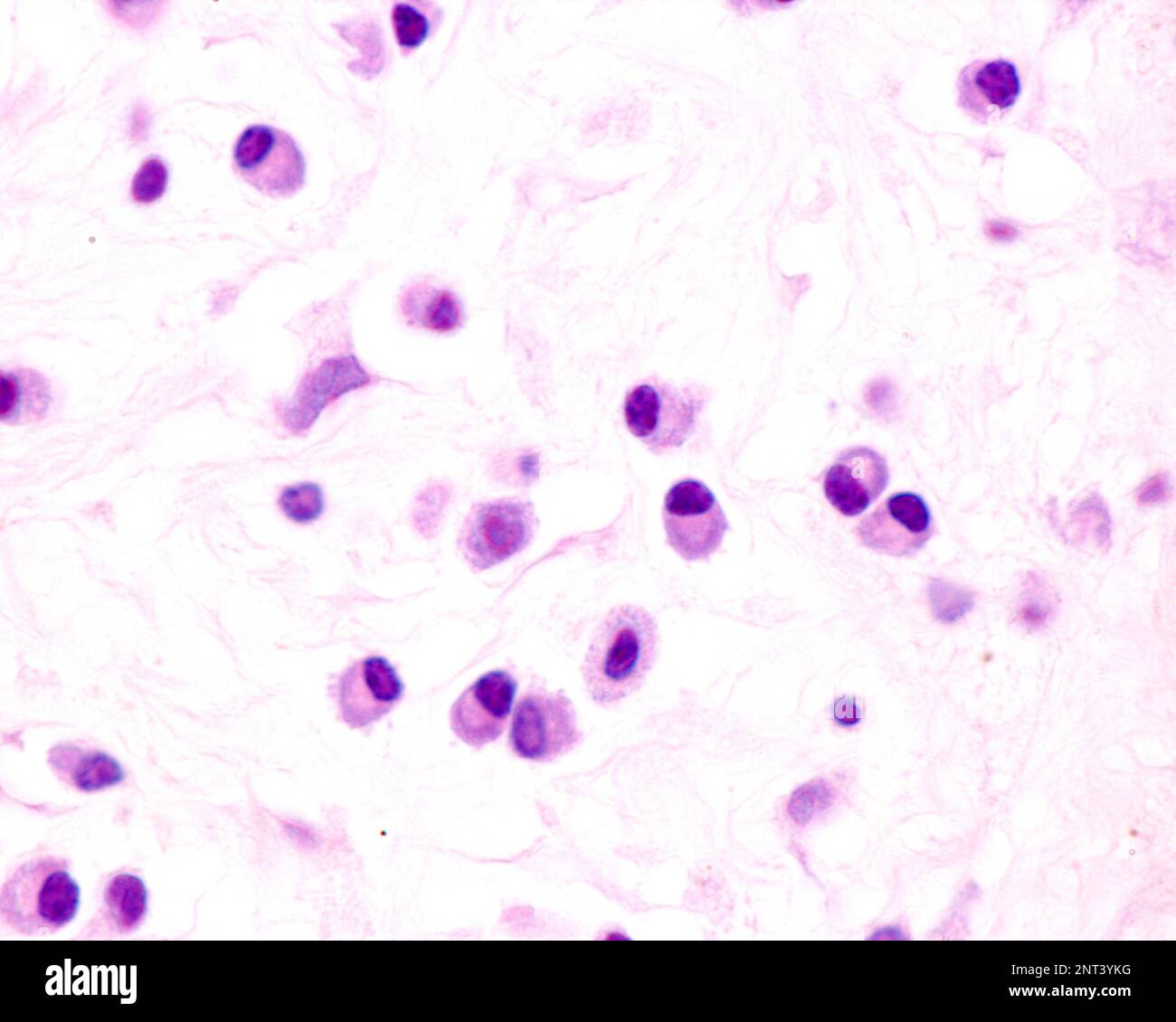 Plasma cells are B lymphocytes activated by the presence of antigens