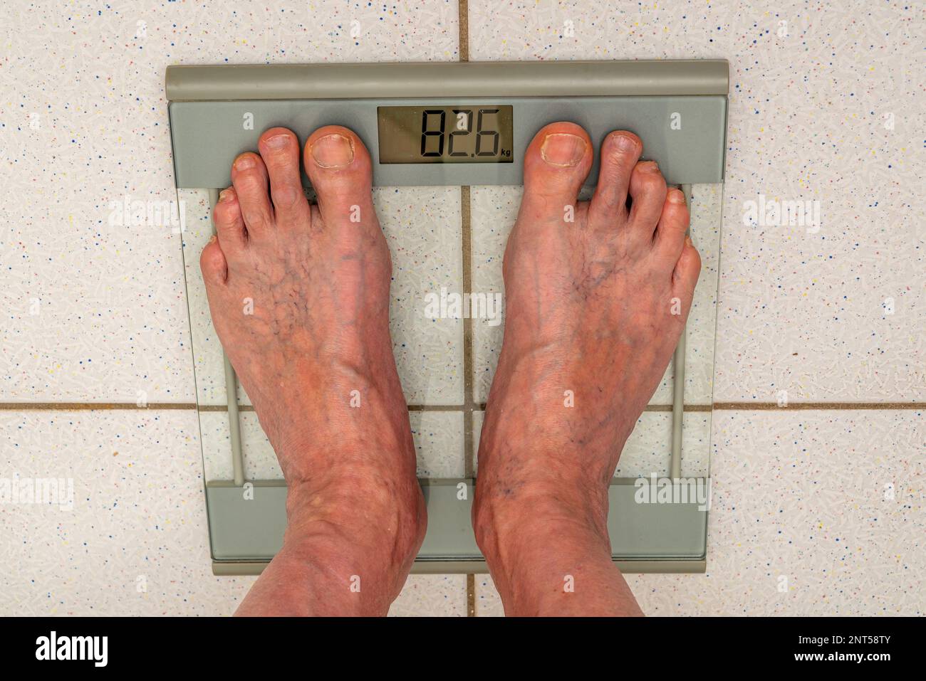 https://c8.alamy.com/comp/2NT58TY/legs-of-an-elderly-man-with-swollen-veins-standing-on-a-floor-scale-close-up-2NT58TY.jpg