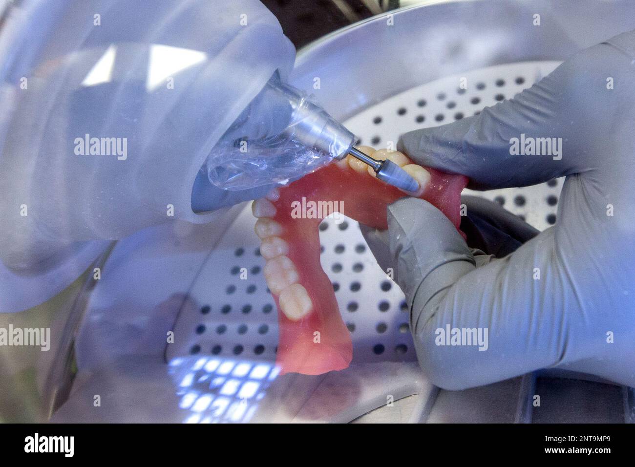 Dr. Chad Taylor smooths out the edges of Beazley Jackson's new 3D printed dentures at the Goree