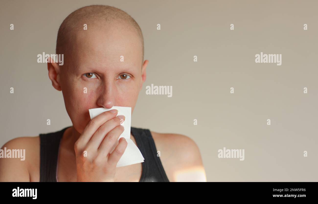 Bald cancer sick woman blowing running nose got flu cough cold