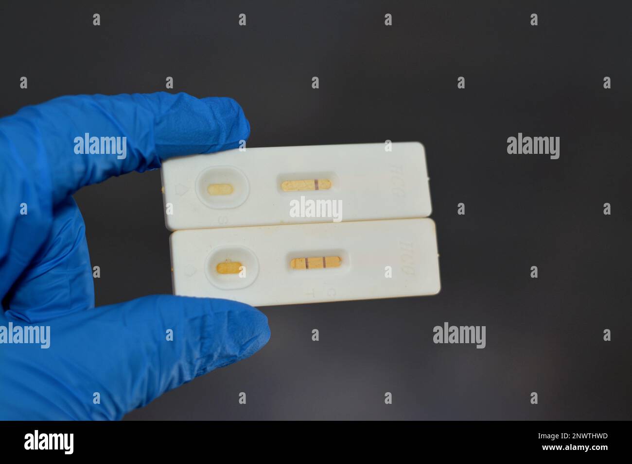 Positive and negative urine pregnancy test, Human chorionic gonadotropin (hCG), a hormone for