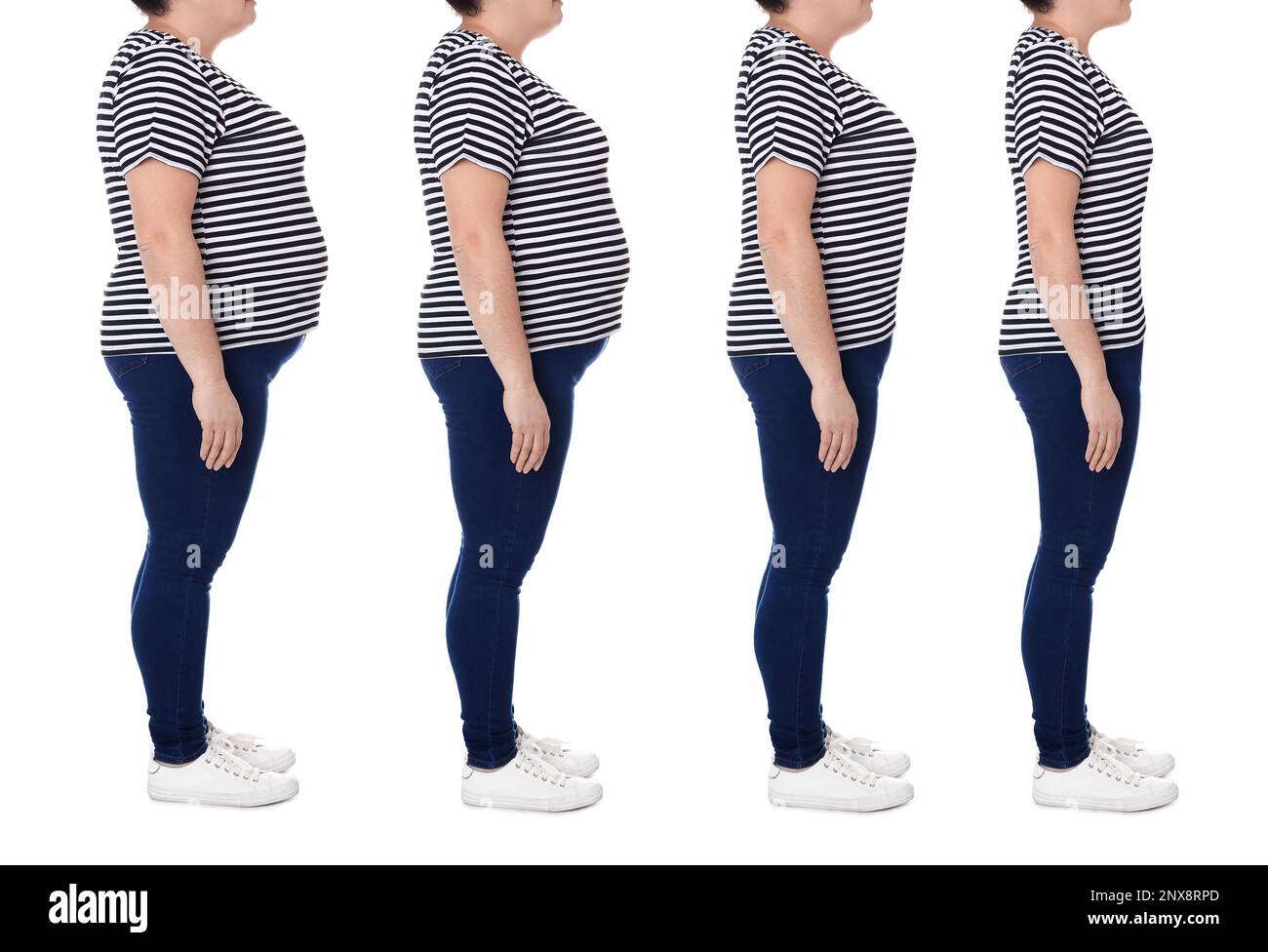 Collage with photos of woman before and after weight loss diet on white