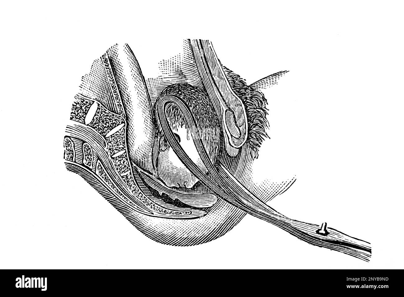 Forceps baby hires stock photography and images Alamy