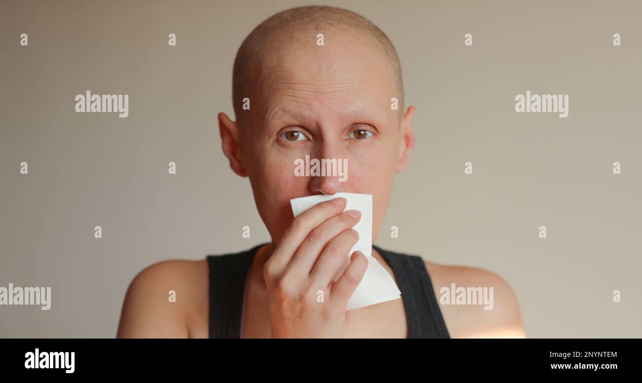 Bald cancer sick woman blowing running nose got flu cough cold
