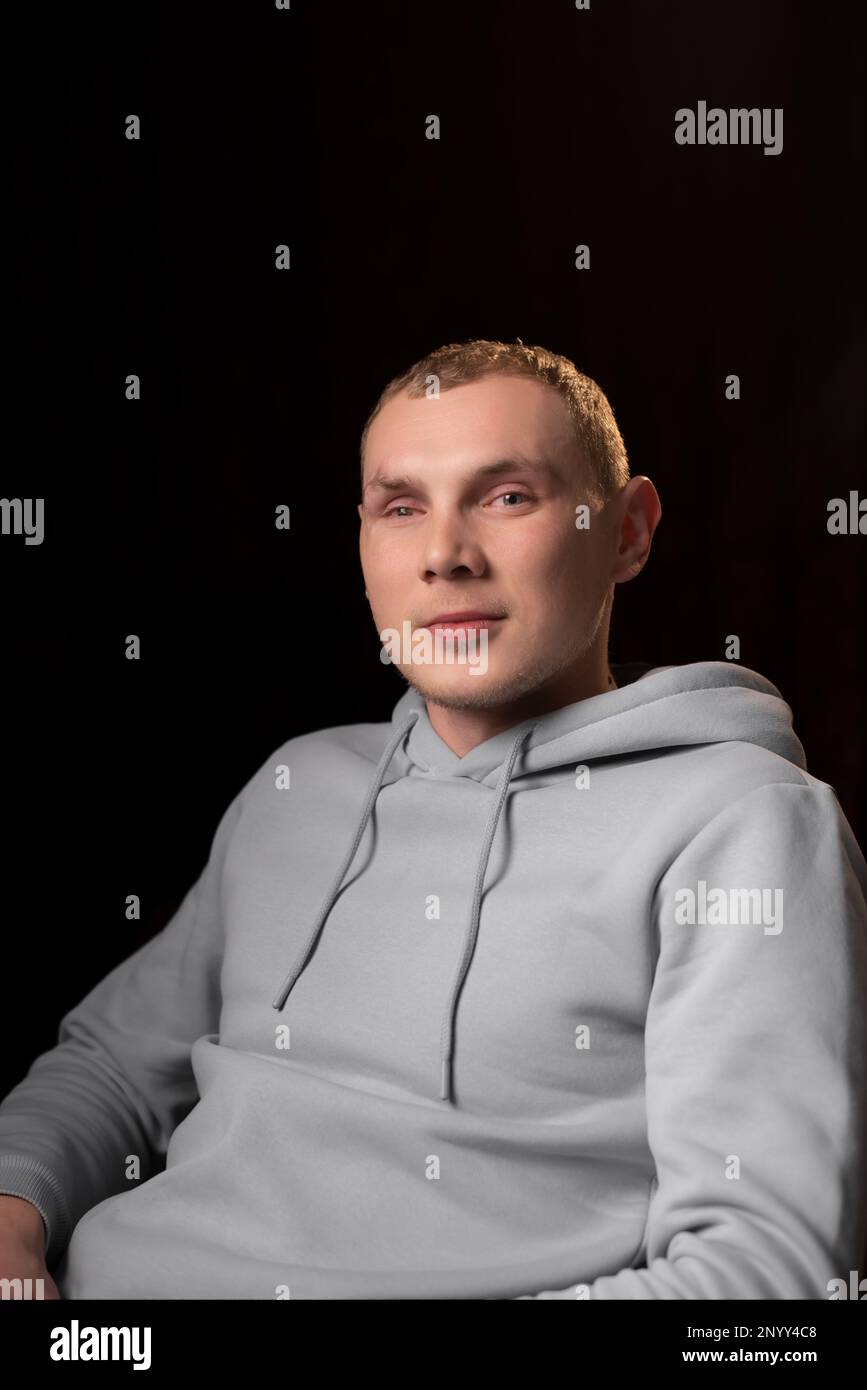 Portrait of a young man with a mutilated eye. Dark background. A young