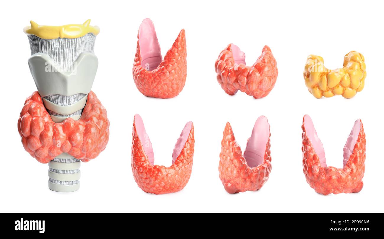 Plastic models of healthy and afflicted thyroid on white background, collage Stock Photo