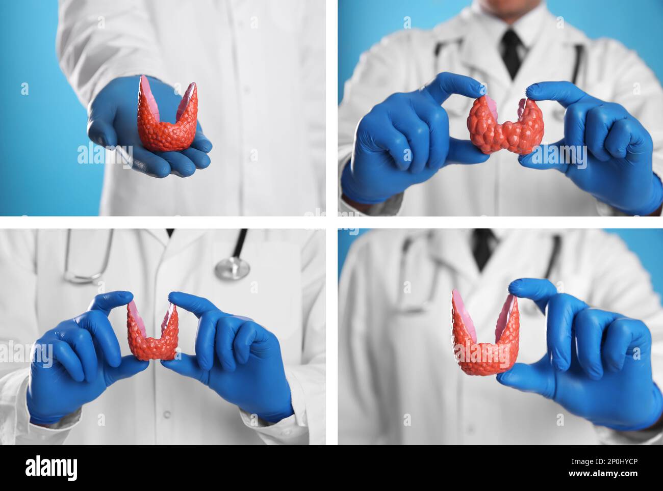 Doctor holding plastic model of thyroid on light blue background, closeup. Collage with photos Stock Photo