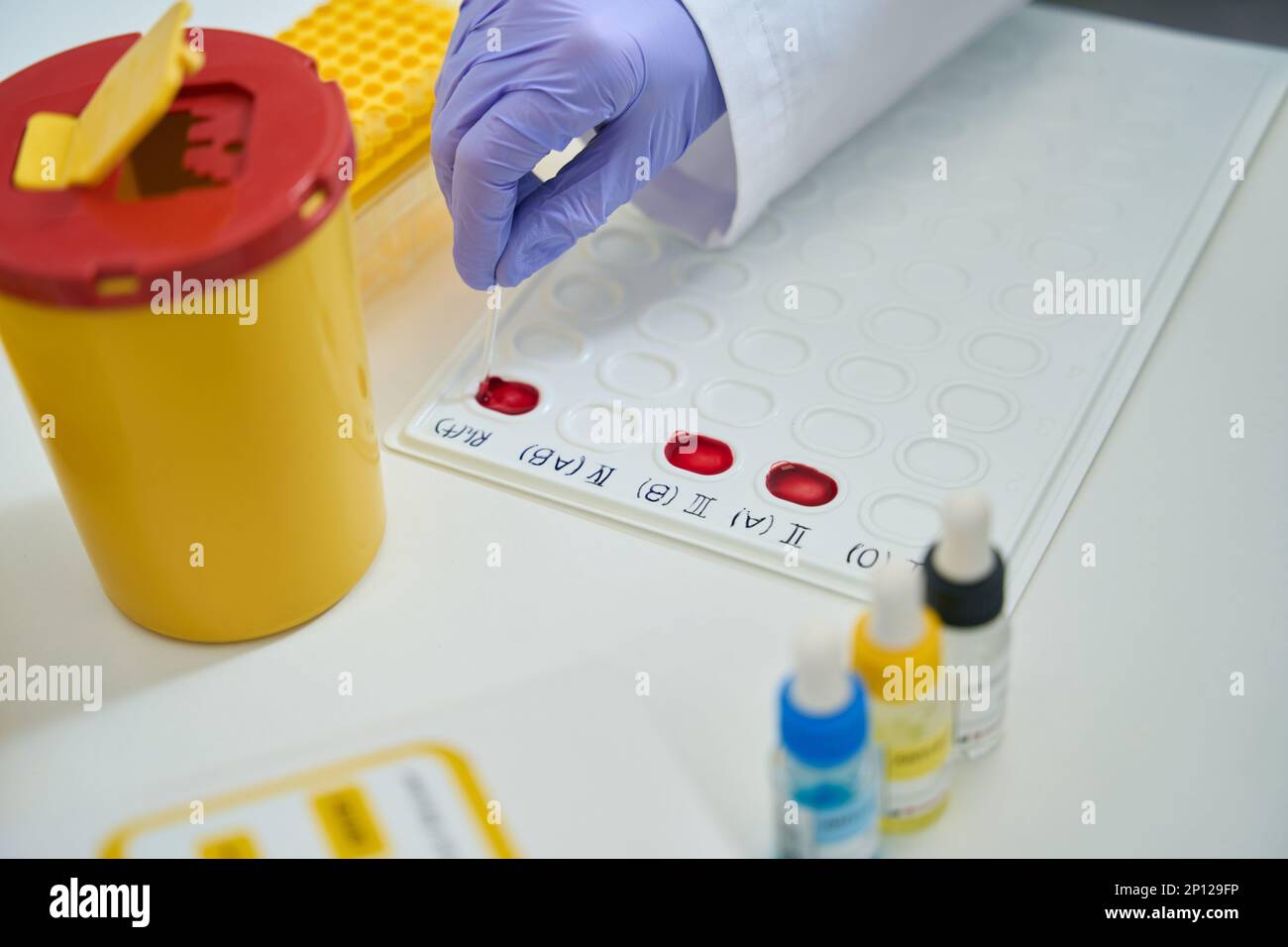 Laboratory assistant works with blood samples on an indication palette