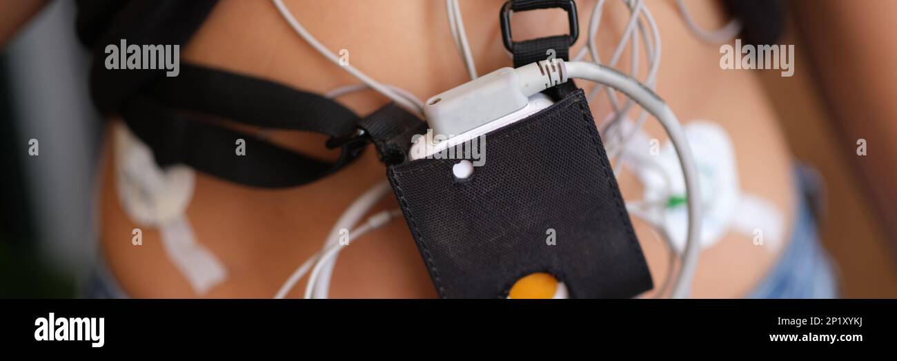 Ecg holter monitor hanging on patient body closeup Stock Photo - Alamy
