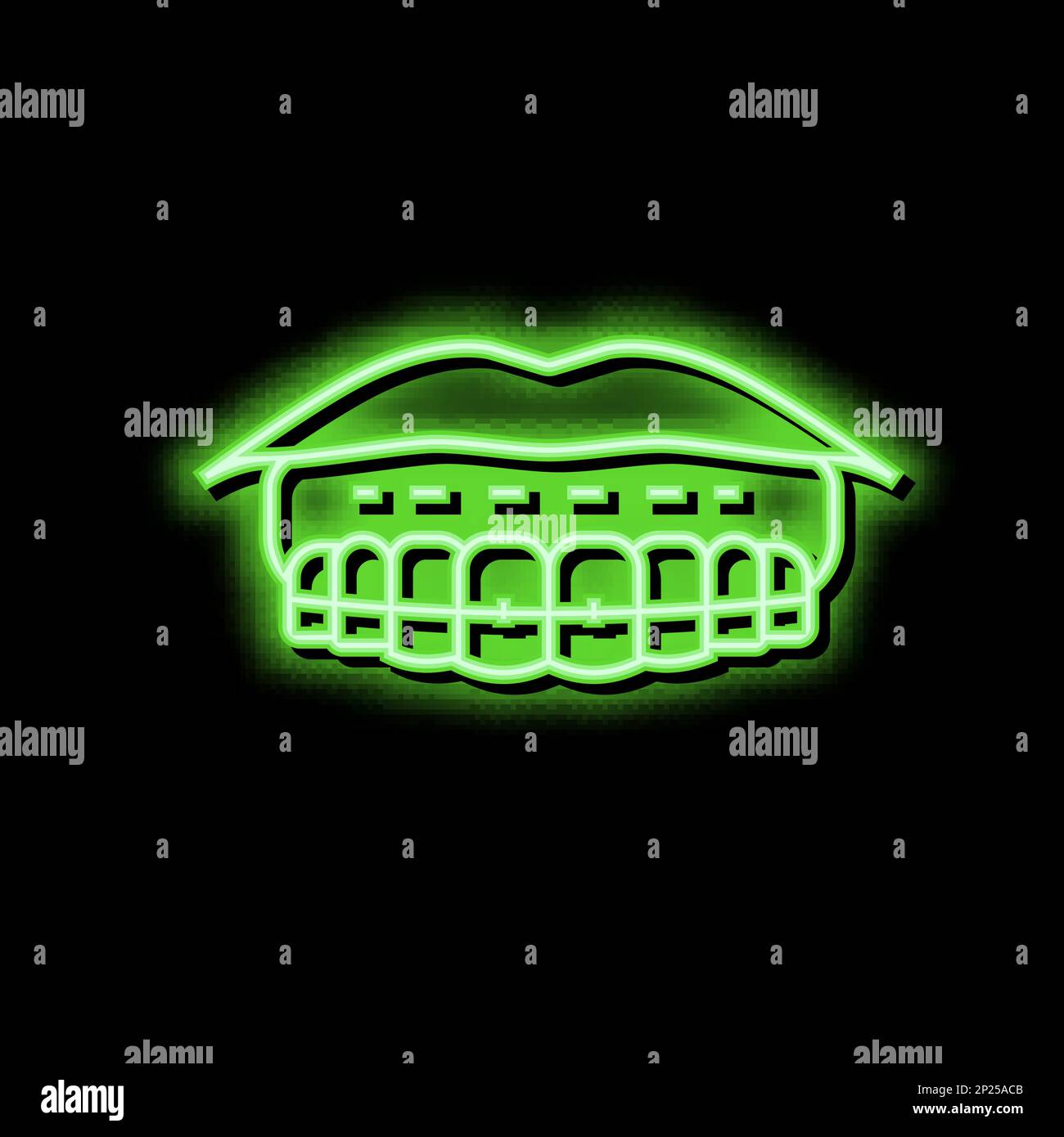 sticking to lips tooth braces neon glow icon illustration Stock Vector ...