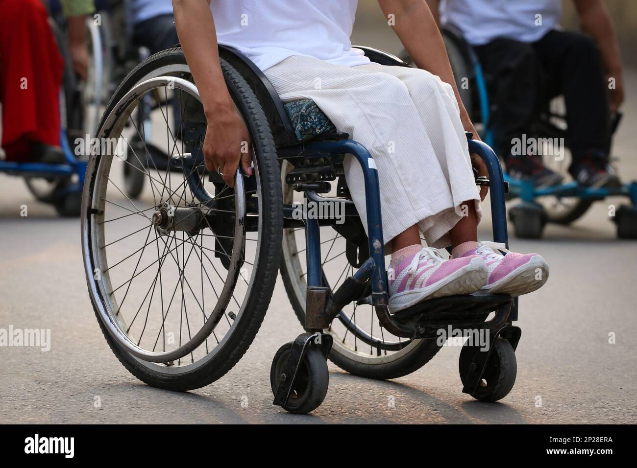On March 4, 2023 in Kathmandu, Nepal. Differently abled legs is
