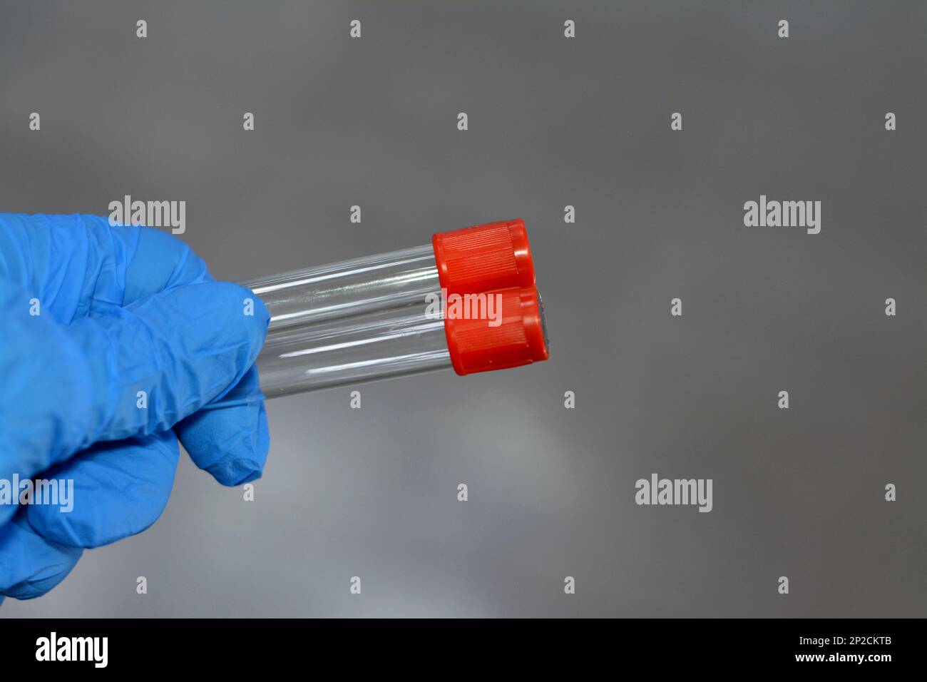 Blood collection tube for collecting blood samples for laboratory analysis tests like CBC complete blood count, ESR, CRP, FBS, HbA1C, kidney and liver Stock Photo