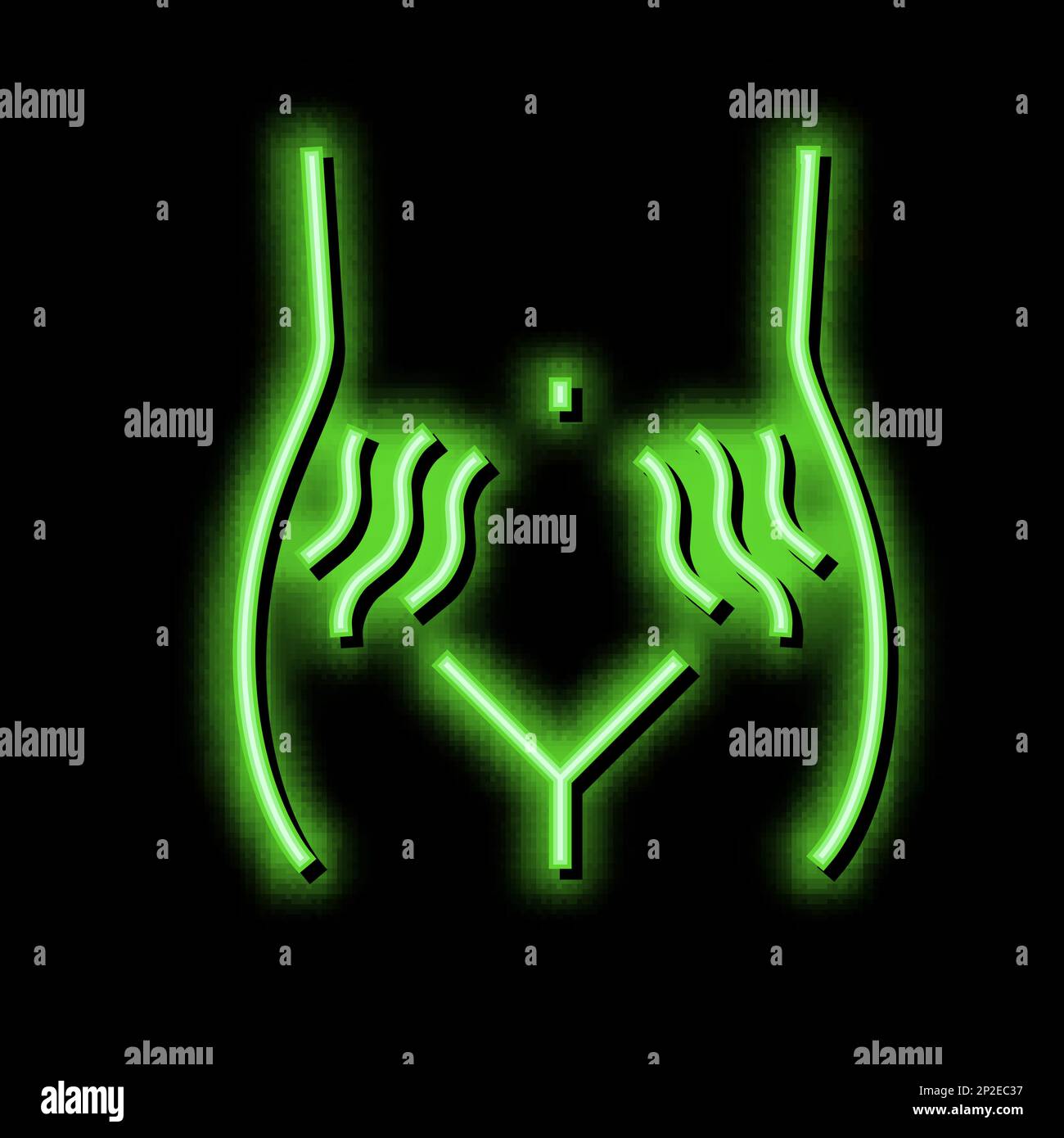 stretch marks on skin disease neon glow icon illustration Stock Vector