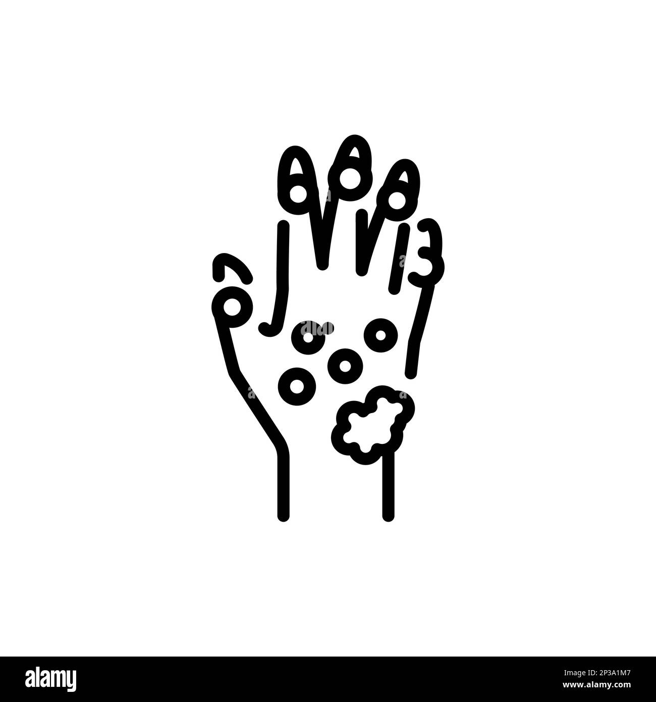 Psoriatic skin black and white stock photos images alamy
