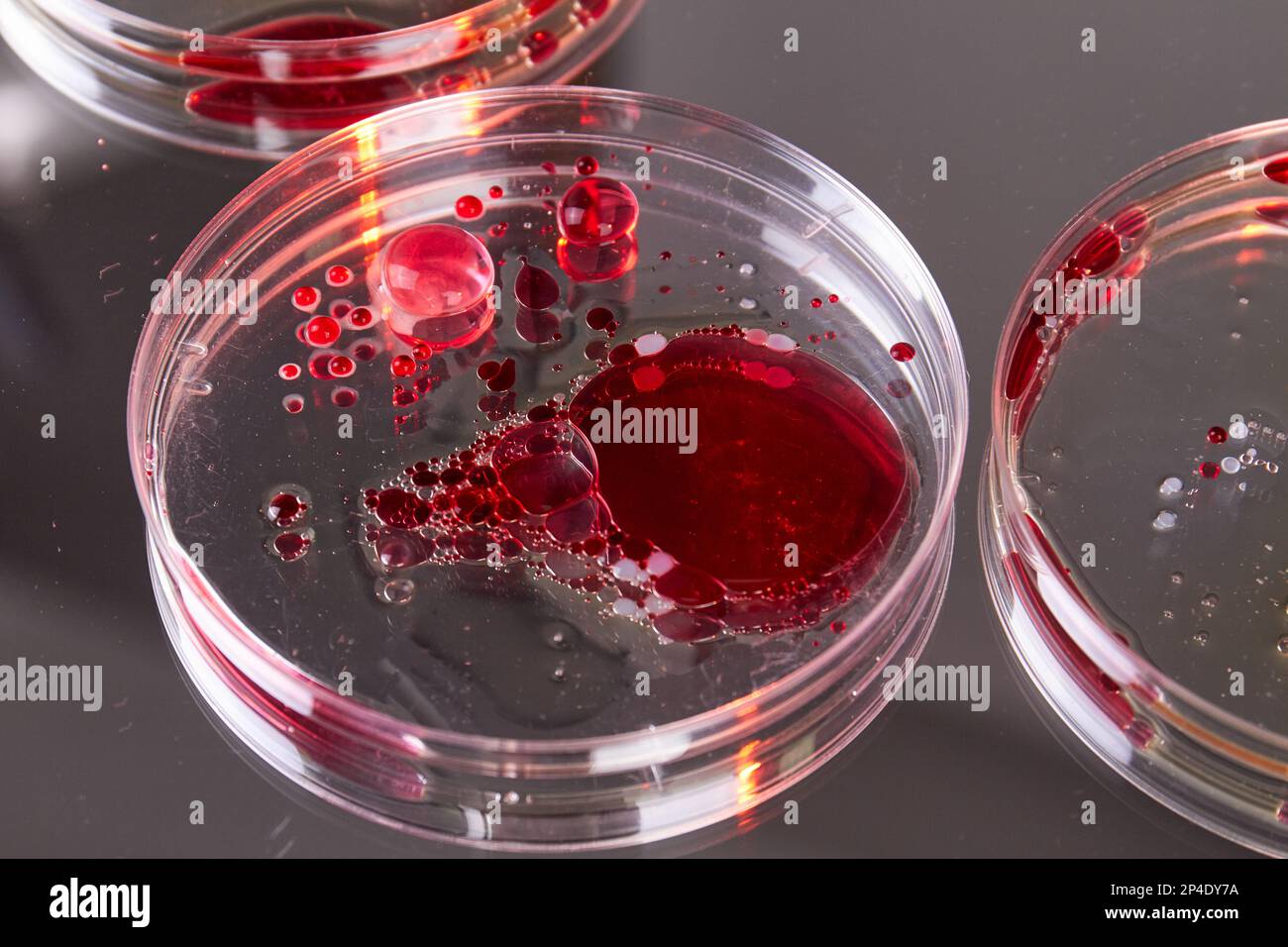Close up lab petri dishes with blood samples. Agar for biological