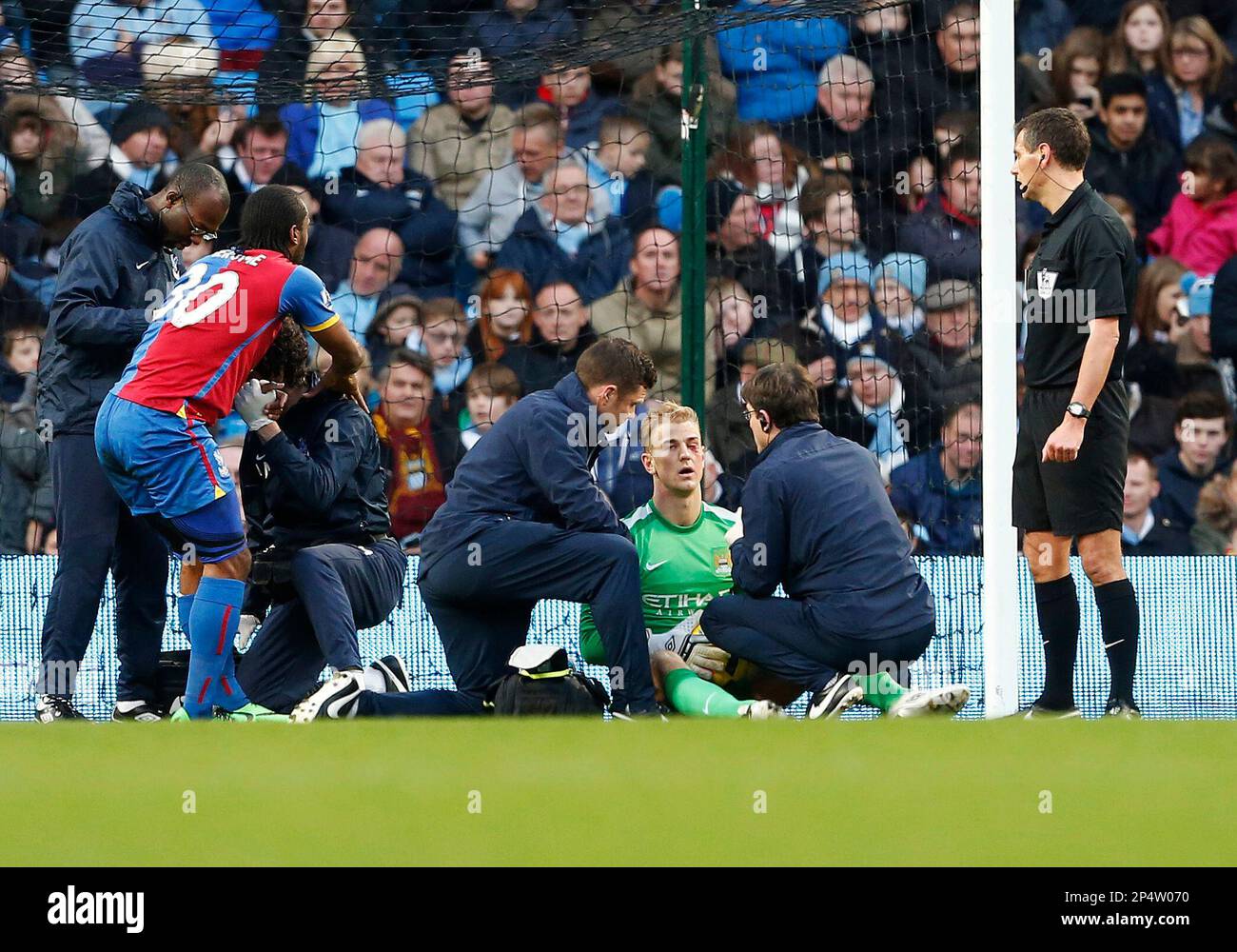 Dec. 28, 2013 - Manchester, United Kingdom - Manchester City's Joe Hart  looks on with a black eye after a clash with Crystal Palace's Cameron  Jerome..Manchester City vs Crystal Palace - Premier, image size:1300x1000