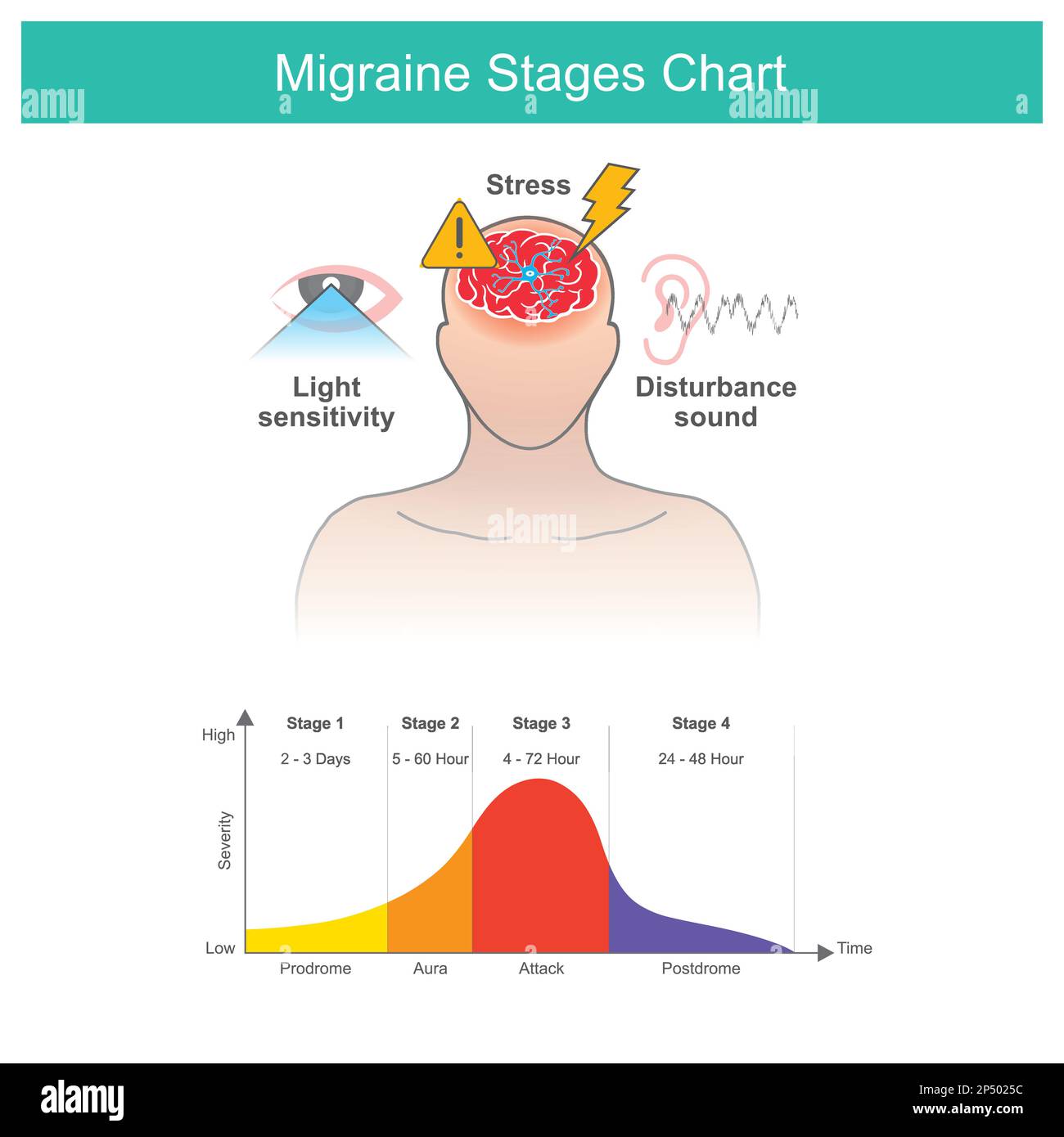 Migraines stages chart, Migraines stages chart and a factors cause of Migraines symptom. Stock Vector