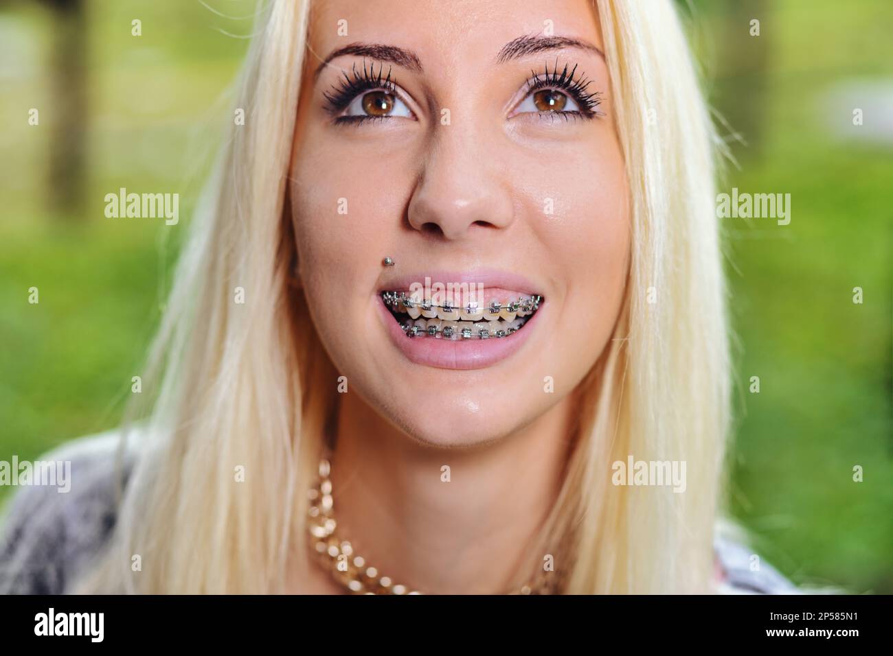 In this portrait of a smiling girl, the two rows of teeth with braces