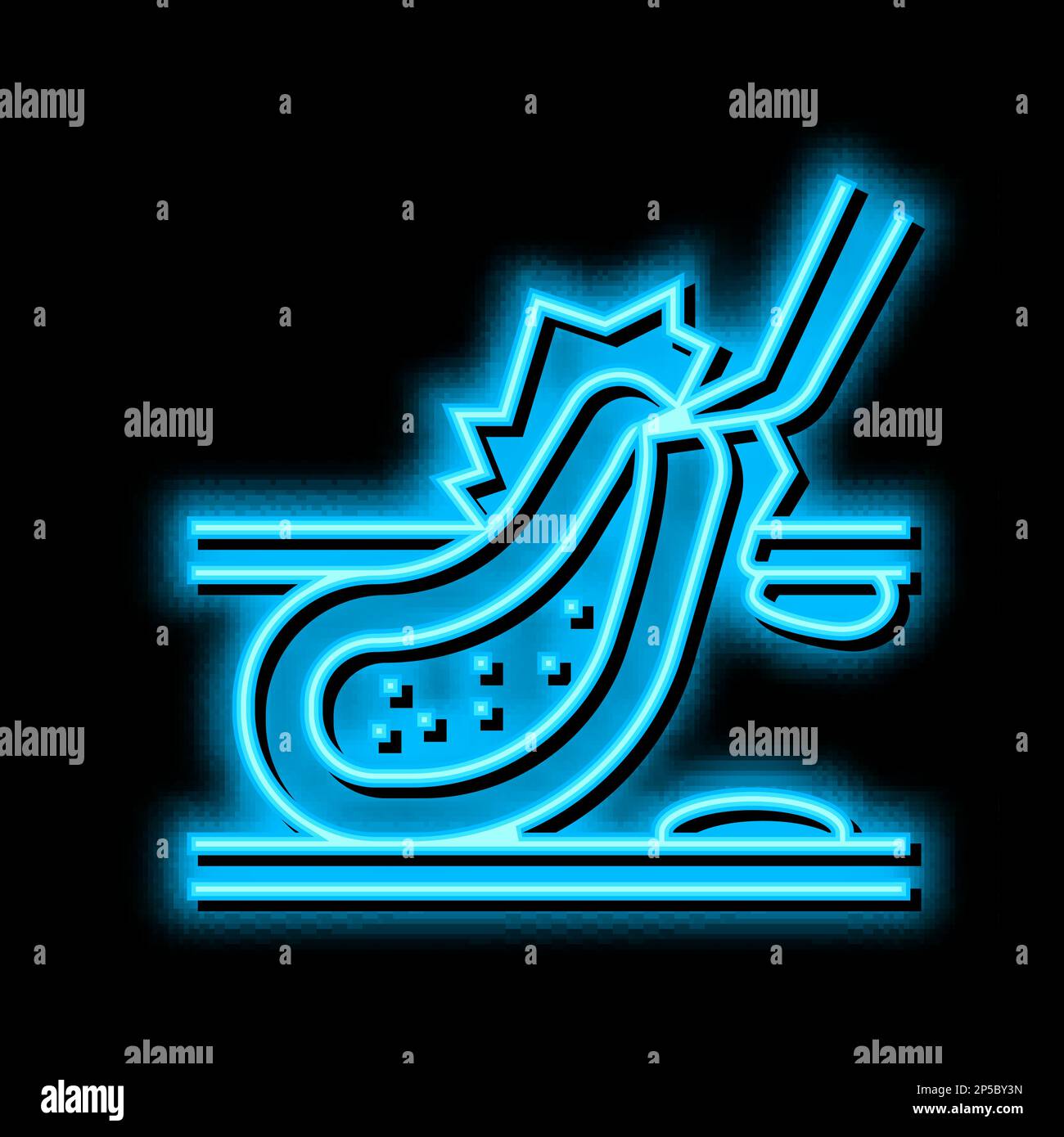 Carotid Endarterectomy Neon Glow Icon Illustration Stock Vector Image carotid-endarterectomy-neon-glow-icon-illustration-stock-vector-image