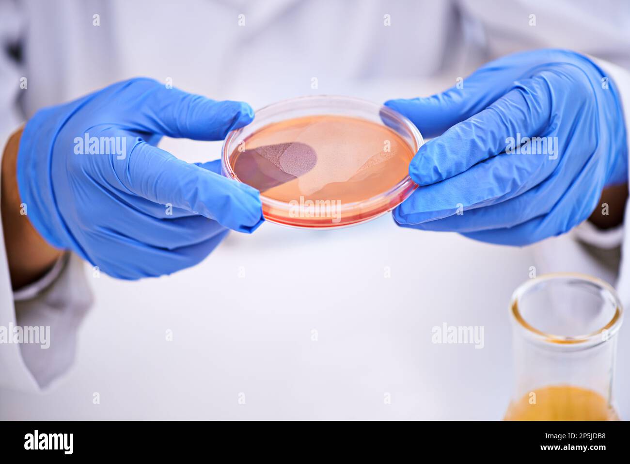 Lets see what the bacteria are up to. Closeup shot of a scientist ...