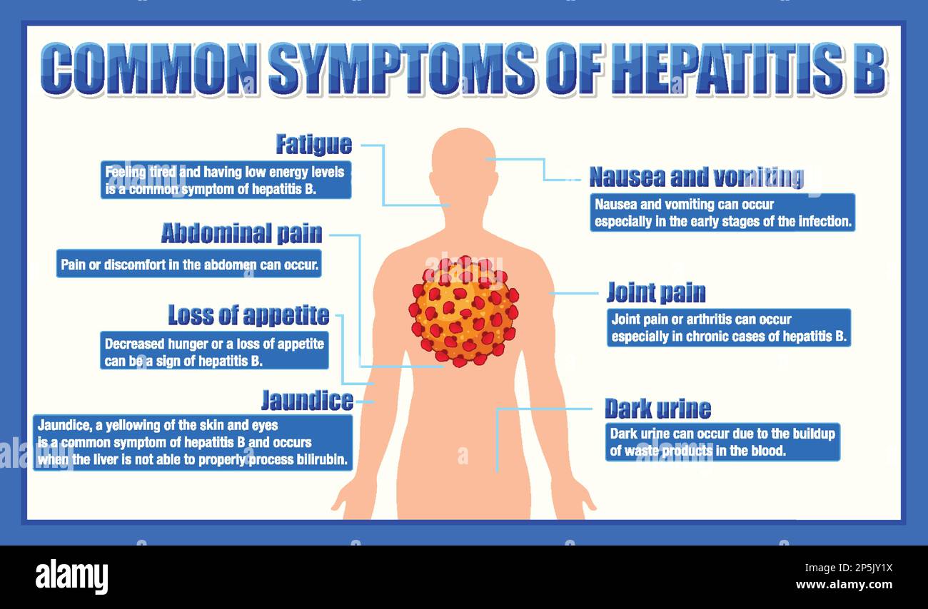 Informative poster of common symptoms Hepatitis B illustration Stock ...