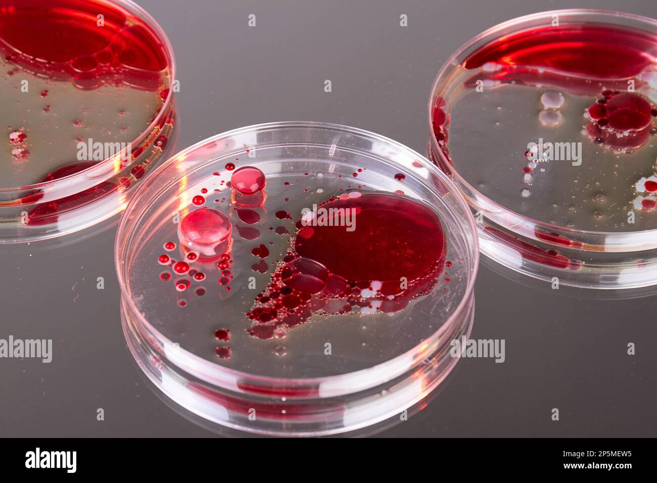 Close up of glass agars with blood samples. Petri dishes for scientific