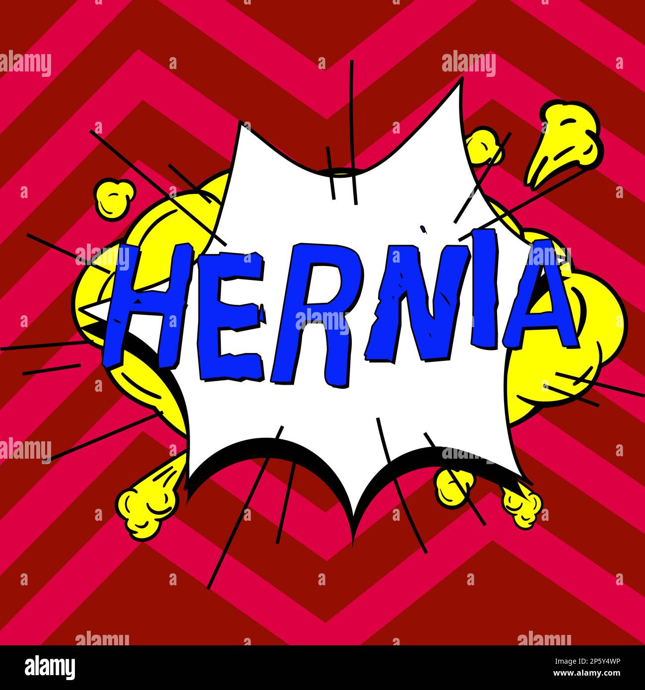Hand writing sign hernia word for abnormal exit of tissue or an organ