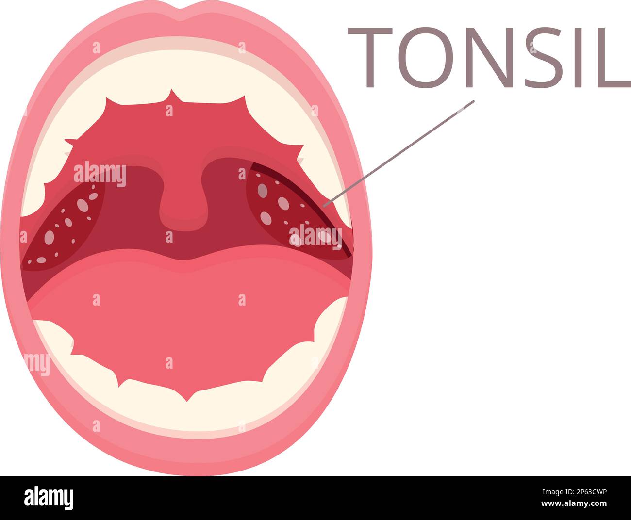 Mouth tonsillitis icon cartoon vector. Bacterial hygiene. Cancer