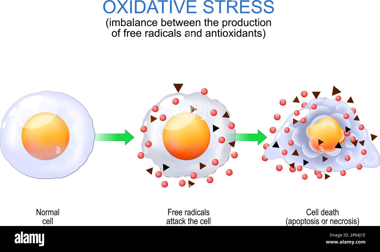 Oxidative stress. imbalance between the production of free radicals and antioxidants. From Normal cell to attack of Free radicals and Cell death Stock Vector