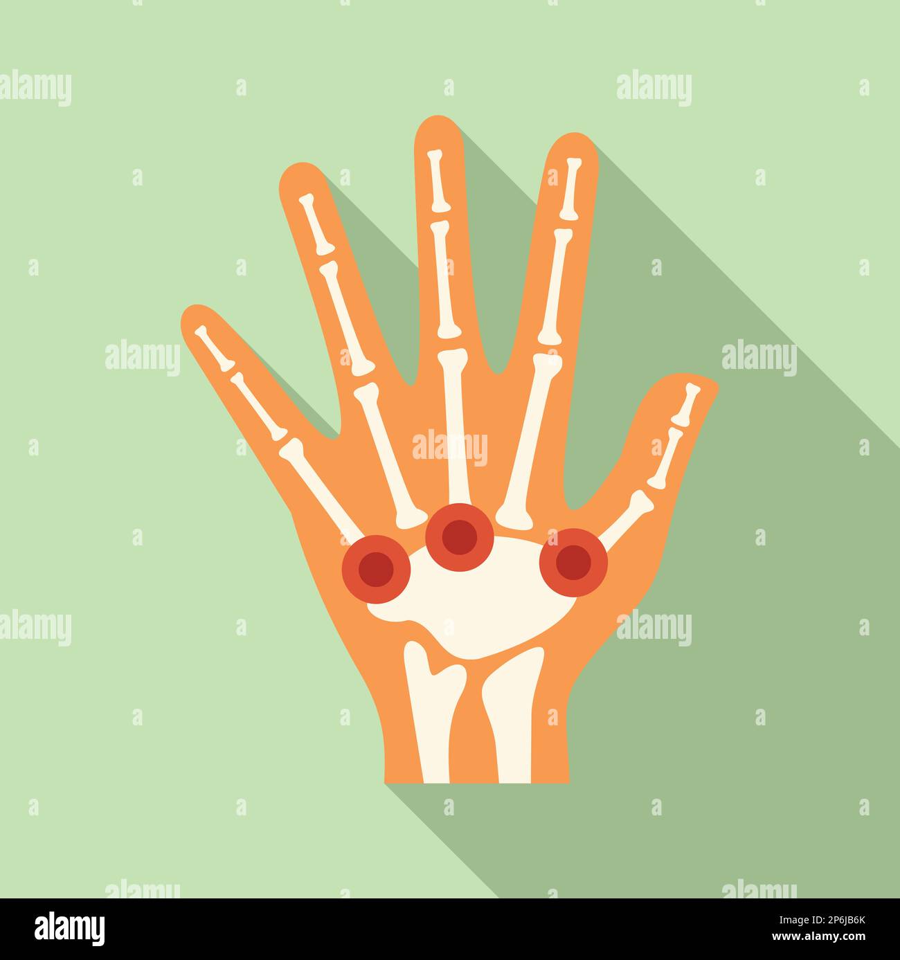 Hand arthritis icon flat vector. Medical disease. Body rheumatism Stock ...